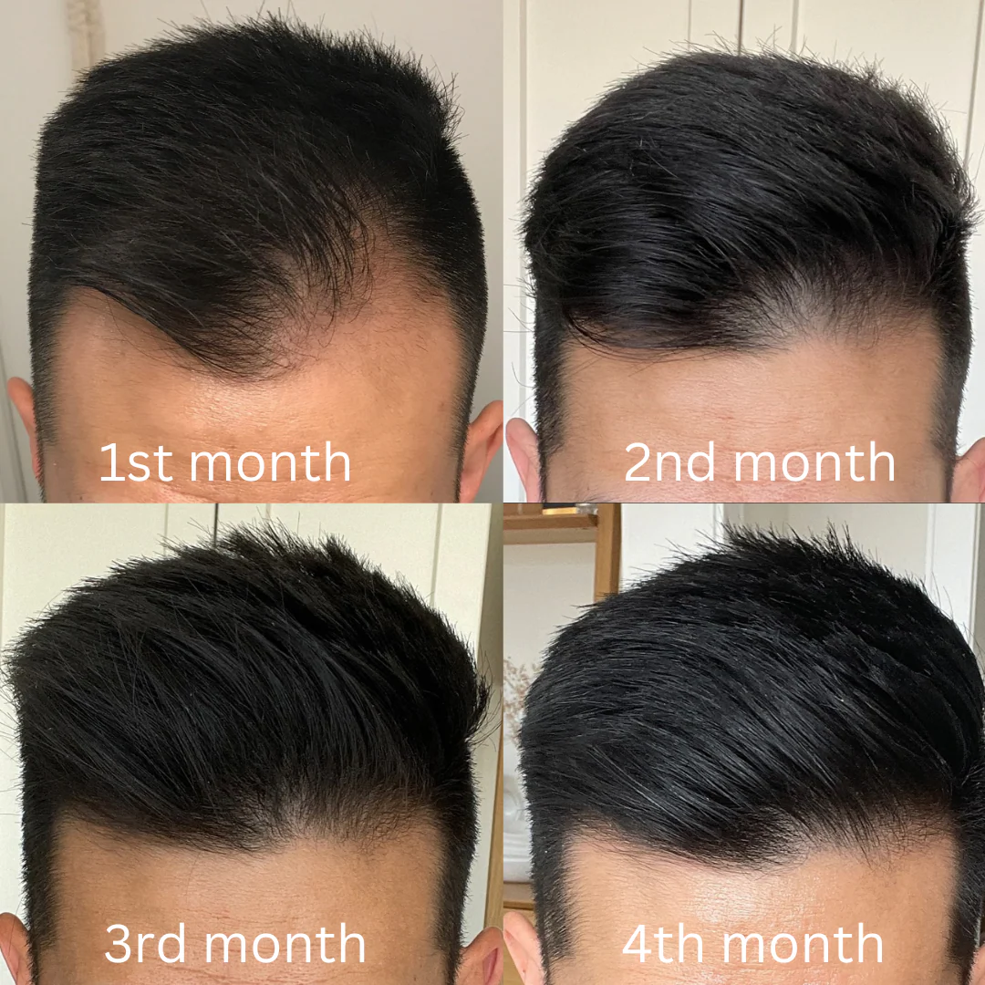 Intense Growth Hair Oil