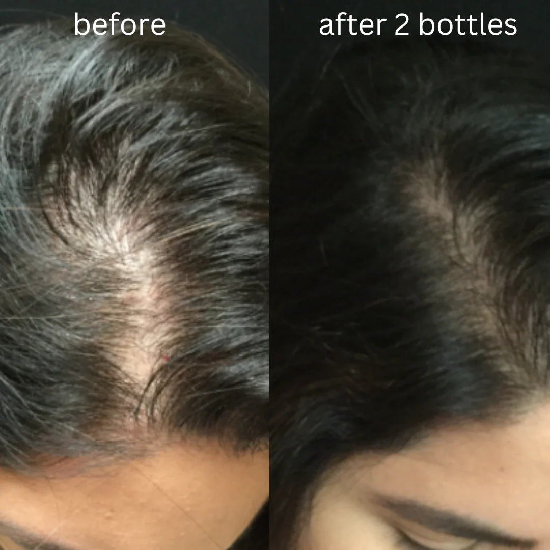 Intense Growth Hair Oil