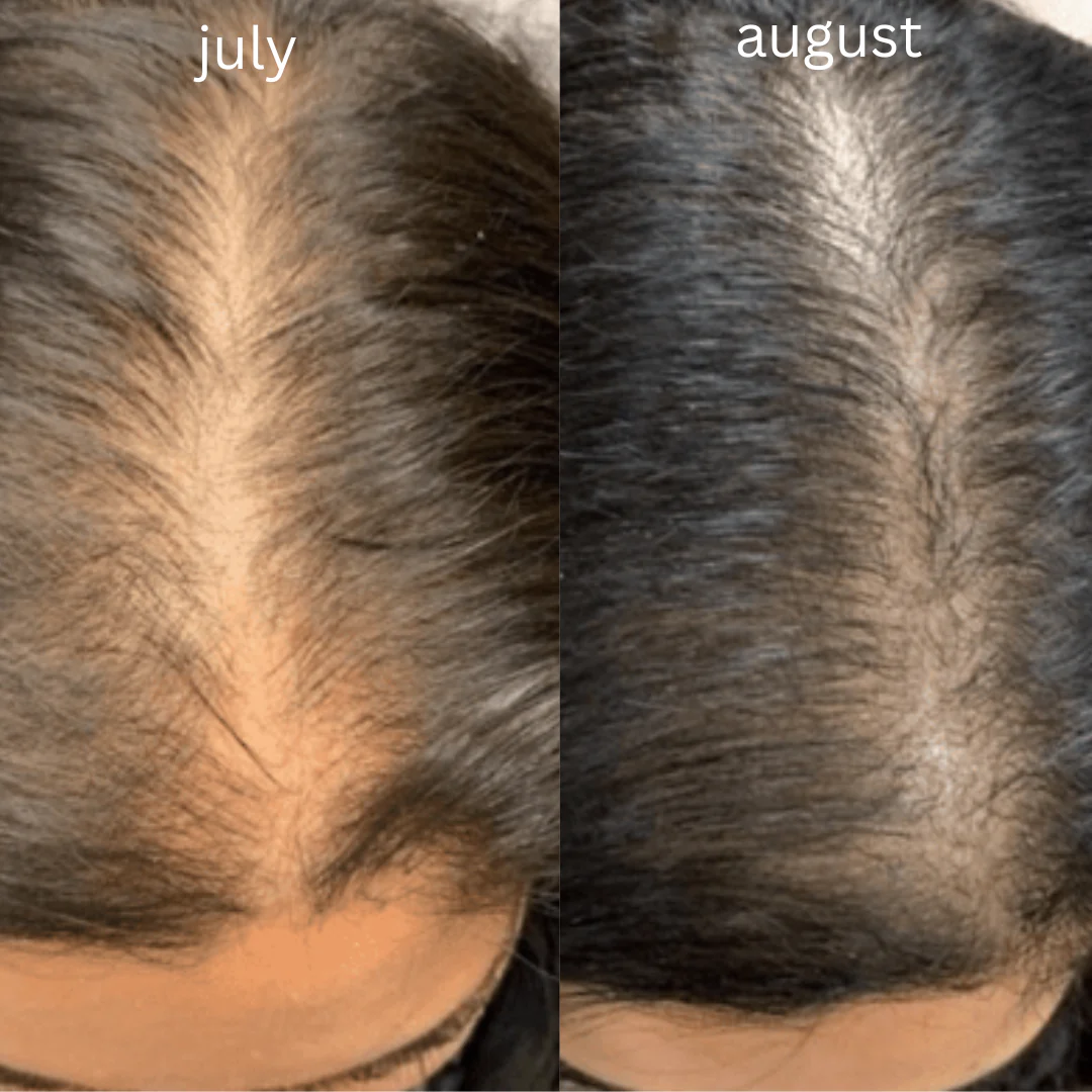 Intense Growth Hair Oil